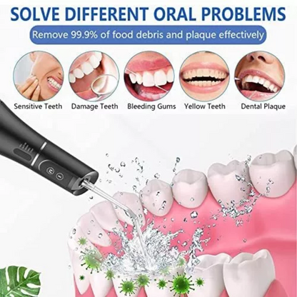 Irrigador Dental Limpiador A Presion